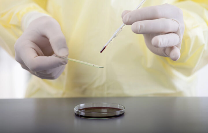 Pipeta de laboratorio sobre placas Petri rellenas de rojo
